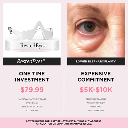 RestedEyes® 2-in-1 Red Light Therapy + Eye Bag Cream